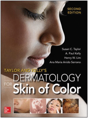 TAYLOR AND KELLY'S DERMATOLOGY FOR SKIN OF COLOR. 2ND EDITION