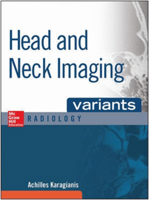 VARIANTS HEAD AND NECK IMAGING