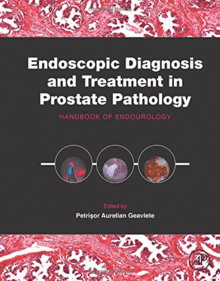 ENDOSCOPIC DIAGNOSIS AND TREATMENT IN PROSTATE PATHOLOGY. HANDBOOK OF ENDOUROLOGY. PRINT ON DEMAND