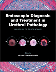 ENDOSCOPIC DIAGNOSIS AND TREATMENT IN URETHRAL PATHOLOGY. HANDBOOK OF ENDOUROLOGY. PRINT ON DEMAND
