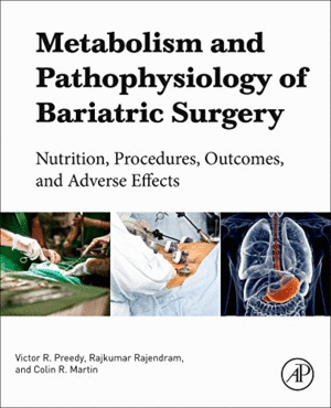 METABOLISM AND PATHOPHYSIOLOGY OF BARIATRIC SURGERY. NUTRITION, PROCEDURES, OUTCOMES AND ADVERSE EFFECTS