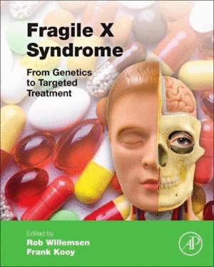 FRAGILE X SYNDROME. FROM GENETICS TO TARGETED TREATMENT