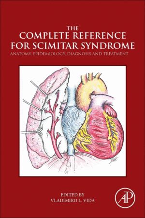 THE COMPLETE REFERENCE FOR SCIMITAR SYNDROME. ANATOMY, EPIDEMIOLOGY, DIAGNOSIS AND TREATMENT