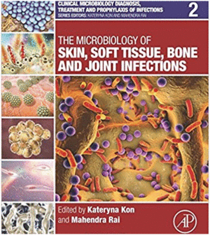 THE MICROBIOLOGY OF SKIN, SOFT TISSUE, BONE AND JOINT INFECTIONS. VOLUME 2
