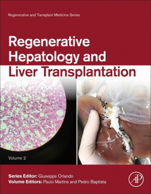 REGENERATIVE HEPATOLOGY AND LIVER TRANSPLANTATION. VOLUME 2