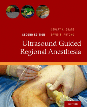 ULTRASOUND GUIDED REGIONAL ANESTHESIA. 2ND EDITION