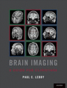 BRAIN IMAGING. A GUIDE FOR CLINICIANS