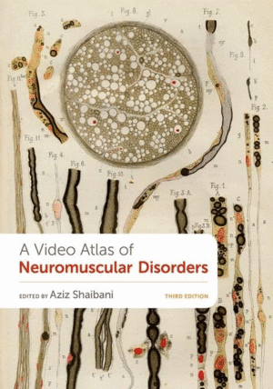 A VIDEO ATLAS OF NEUROMUSCULAR DISORDERS. 3RD EDITION