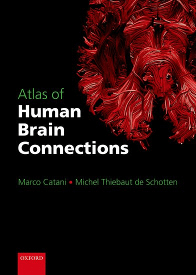 ATLAS OF HUMAN BRAIN CONNECTIONS