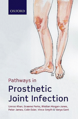 PATHWAYS IN PROSTHETIC JOINT INFECTION