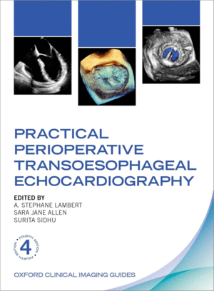 PRACTICAL PERIOPERATIVE TRANSOESOPHAGEAL ECHOCARDIOGRAPHY. 4TH EDITION