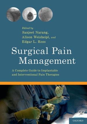 SURGICAL PAIN MANAGEMENT. A COMPLETE GUIDE TO IMPLANTABLE AND INTERVENTIONAL PAIN THERAPIES