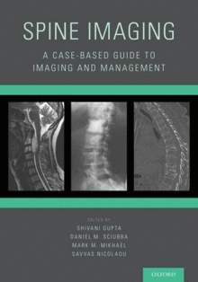 SPINE IMAGING. A CASE-BASED GUIDE TO IMAGING AND MANAGEMENT