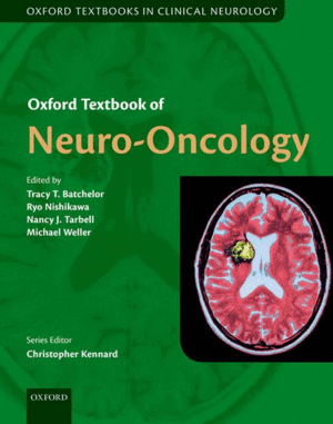 OXFORD TEXTBOOK OF NEURO-ONCOLOGY