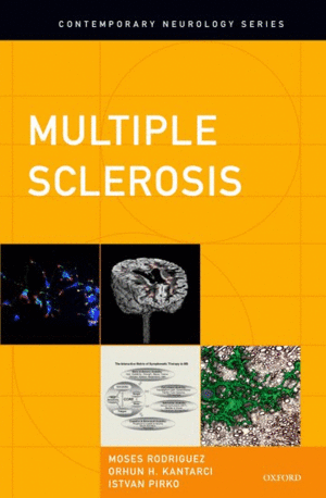 MULTIPLE SCLEROSIS. CONTEMPORARY NEUROLOGY SERIES