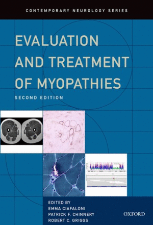 EVALUATION AND TREATMENT OF MYOPATHIES. 2ND EDITION