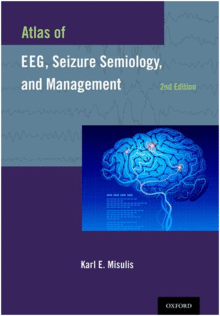 ATLAS OF EEG, SEIZURE SEMIOLOGY, AND MANAGEMENT. 2ND EDITION