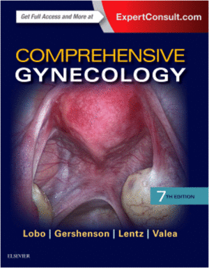 COMPREHENSIVE GYNECOLOGY, 7TH EDITION