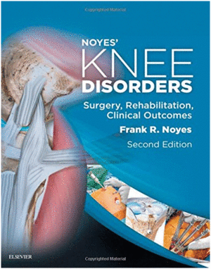 NOYES' KNEE DISORDERS: SURGERY, REHABILITATION, CLINICAL OUTCOMES, 2ND EDITION