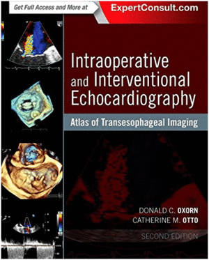 INTRAOPERATIVE AND INTERVENTIONAL ECHOCARDIOGRAPHY, 2ND EDITION. ATLAS OF TRANSESOPHAGEAL IMAGING