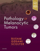 PATHOLOGY OF MELANOCYTIC TUMORS