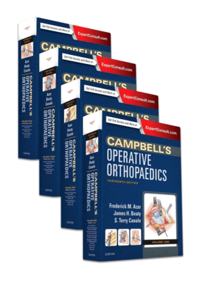 CAMPBELL'S OPERATIVE ORTHOPAEDICS, 4-VOLUME SET, 13TH EDITION
