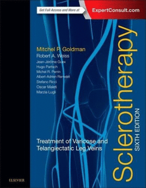 SCLEROTHERAPY, 6TH EDITION. TREATMENT OF VARICOSE AND TELANGIECTATIC LEG VEINS
