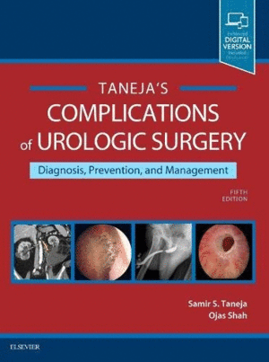 COMPLICATIONS OF UROLOGIC SURGERY, 5TH EDITION. PREVENTION AND MANAGEMENT