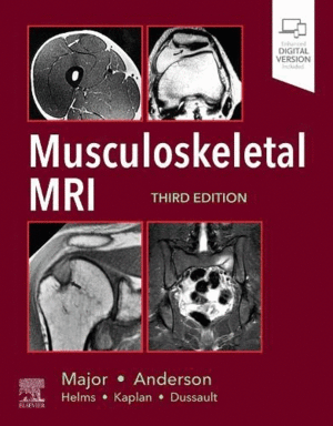 MUSCULOSKELETAL MRI, 3RD EDITION