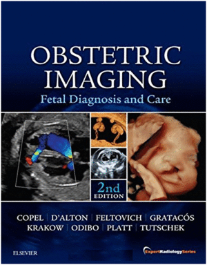 OBSTETRIC IMAGING: FETAL DIAGNOSIS AND CARE, 2ND EDITION
