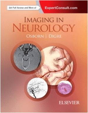 IMAGING IN NEUROLOGY. (ONLINE AND PRINT)