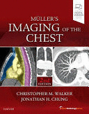 MLLERS IMAGING OF THE CHEST (EXPERT RADIOLOGY SERIES). 2ND EDITION