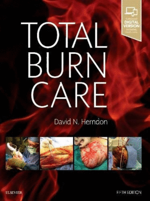 TOTAL BURN CARE. 5TH EDITION