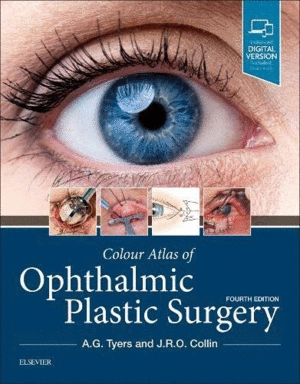COLOUR ATLAS OF OPHTHALMIC PLASTIC SURGERY, 4TH EDITION