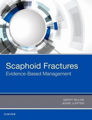 SCAPHOID FRACTURES. EVIDENCE-BASED MANAGEMENT