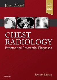 CHEST RADIOLOGY. PATTERNS AND DIFFERENTIAL DIAGNOSES. 7TH EDITION