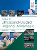ATLAS OF ULTRASOUND-GUIDED REGIONAL ANESTHESIA, 3RD EDITION