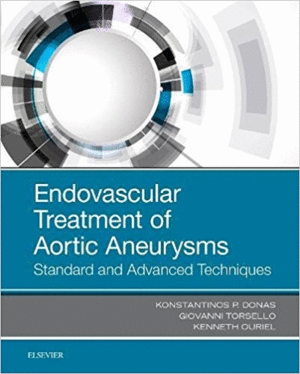 ENDOVASCULAR TREATMENT OF AORTIC ANEURYSMS. STANDARD AND ADVANCED TECHNIQUES