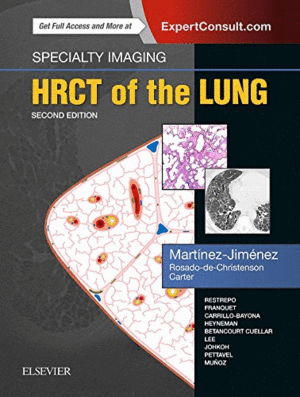SPECIALTY IMAGING: HRCT OF THE LUNG, 2ND EDITION