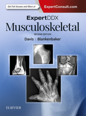 EXPERT DDX: MUSCULOSKELETAL (PRINT + ONLINE). 2ND EDITION