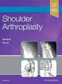SHOULDER ARTHROPLASTY. 2ND EDITION