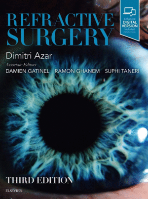 REFRACTIVE SURGERY. 3RD EDITION