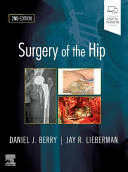 SURGERY OF THE HIP, 2ND EDITION