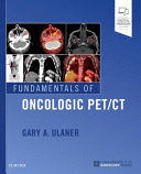 FUNDAMENTALS OF ONCOLOGIC PET/CT