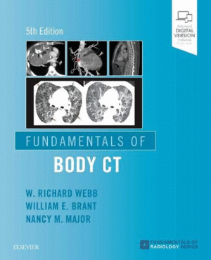 FUNDAMENTALS OF BODY CT, 5TH EDITION