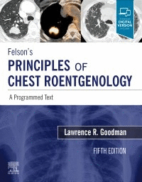 FELSON´S PRINCIPLES OF CHEST ROENTGENOLOGY, A PROGRAMMED TEXT, 5TH EDITION