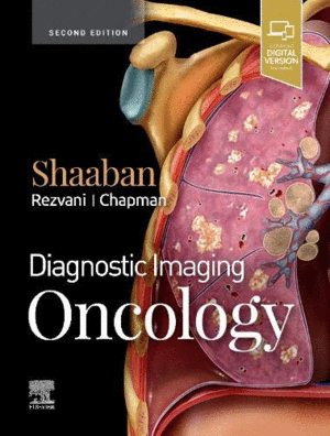 DIAGNOSTIC IMAGING: ONCOLOGY. 2ND EDITION