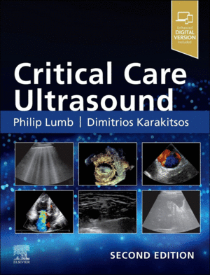 CRITICAL CARE ULTRASOUND. 2ND EDITION
