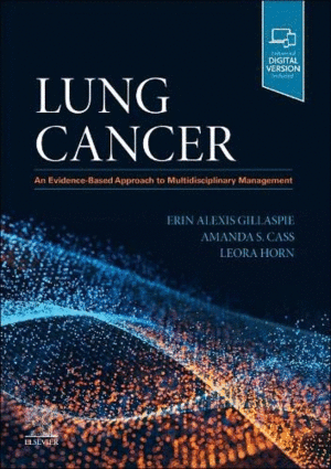 LUNG CANCER. AN EVIDENCE-BASED APPROACH TO MULTIDISCIPLINARY MANAGEMENT