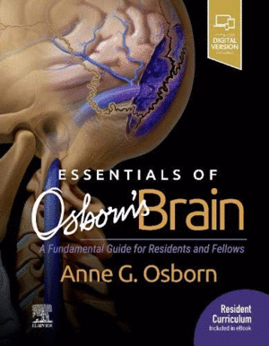 ESSENTIALS OF OSBORN'S BRAIN. A FUNDAMENTAL GUIDE FOR RESIDENTS AND FELLOWS